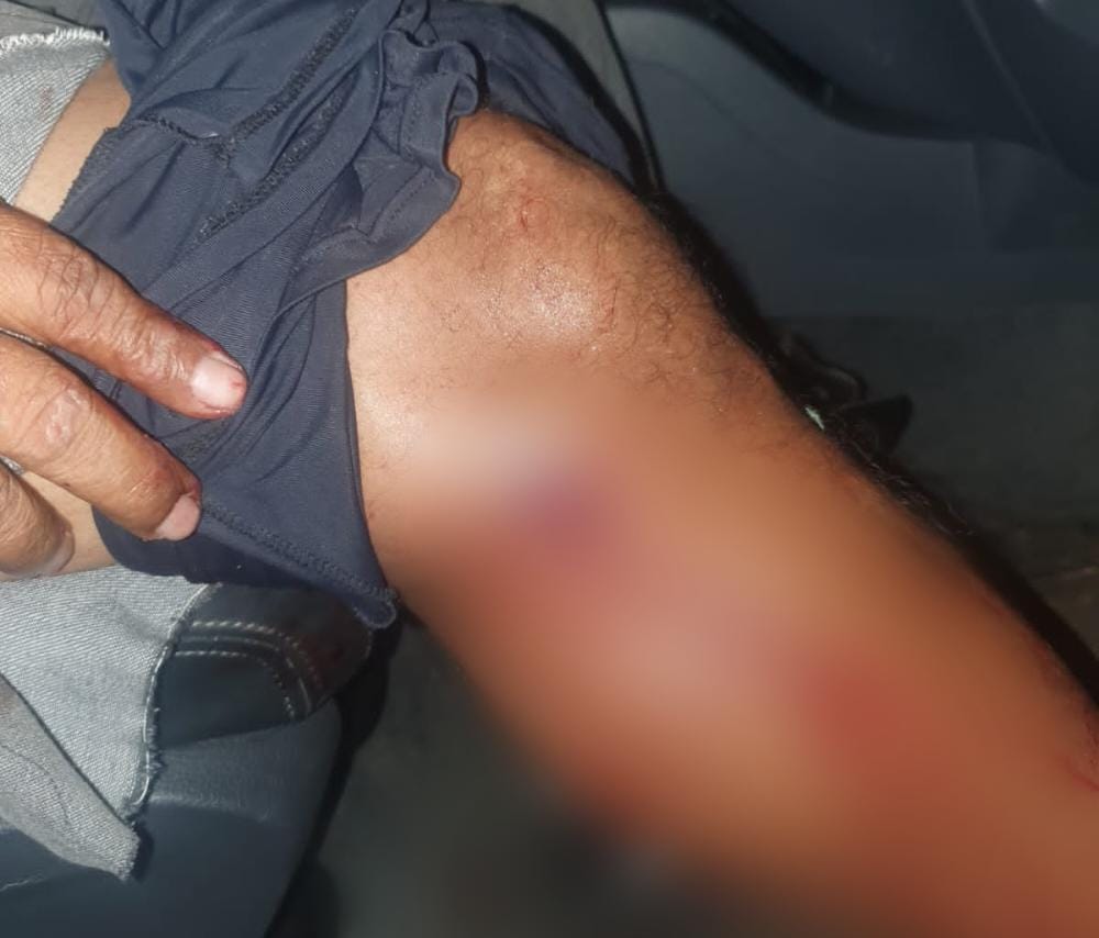 NORBRASIL: Sargento da PM de 55 anos é baleado durante tiroteio em fazenda